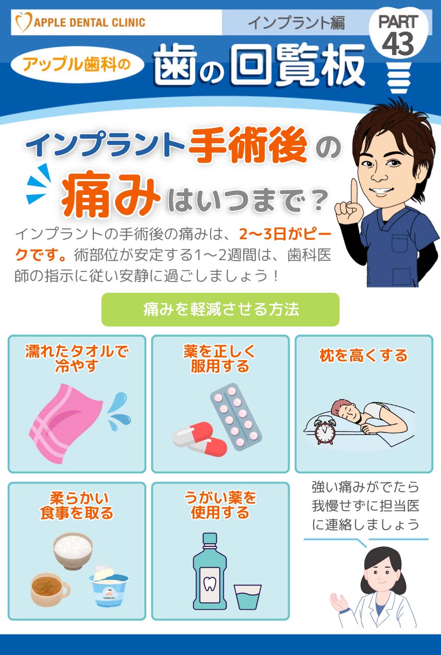 歯の回覧板インプラント編